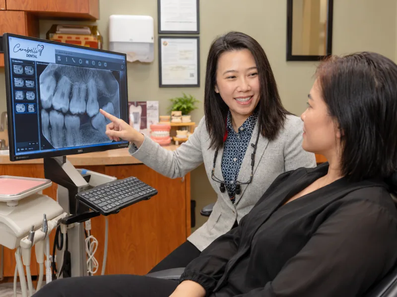 A dentist reviewing a tooth X-ray with an adult patient before discussing extraction options.