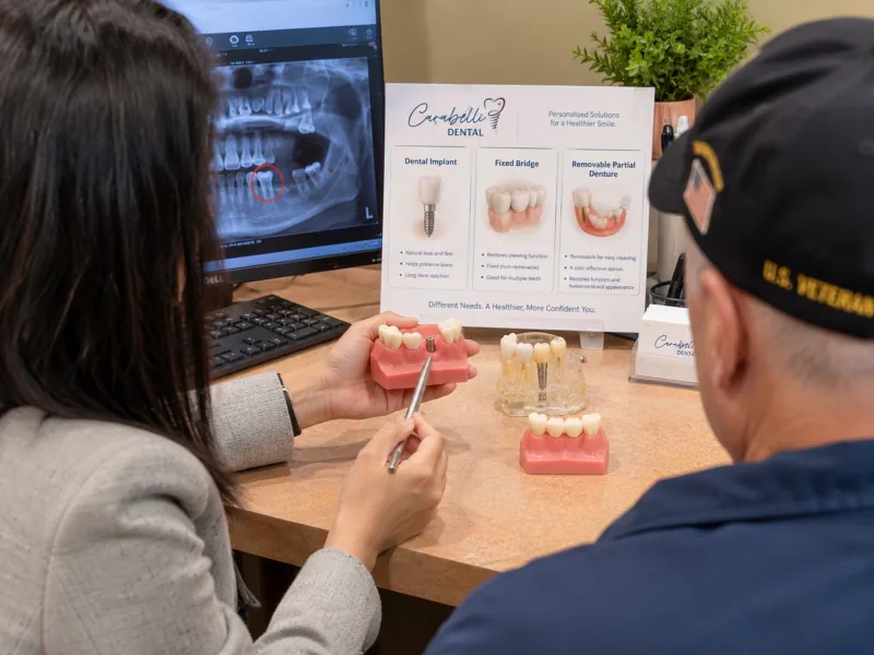 A dentist using a jaw model to explain replacement options after a tooth extraction.